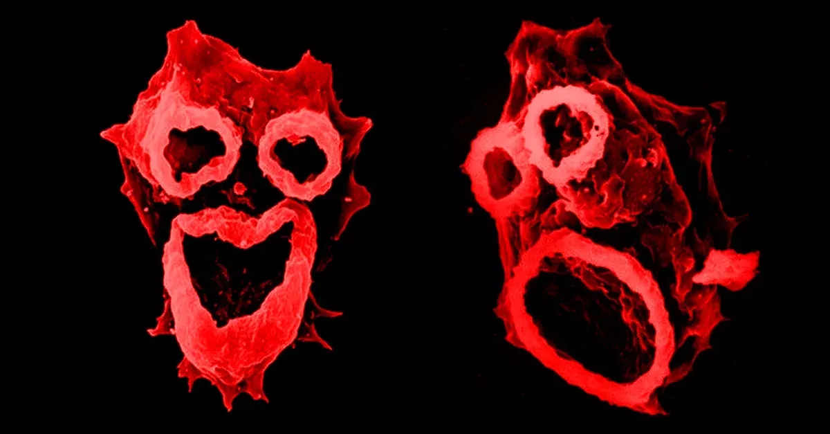 Brain eating amoebae