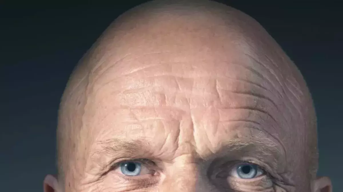 Default image