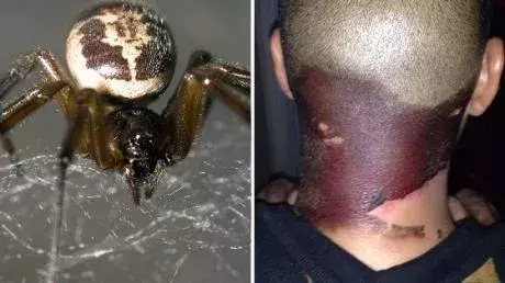 False widow