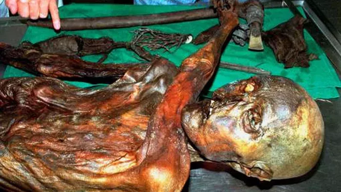 Ötzi