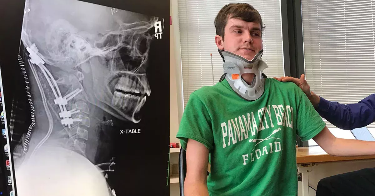 22-Year-Old Cheats Death For A Third Time By Surviving A Deadly 'Internal Decapitation'