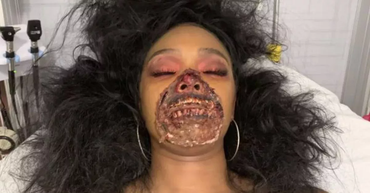 A Dancer In Zombie Makeup Ends Up In Hospital