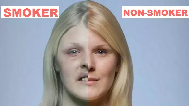 Default image