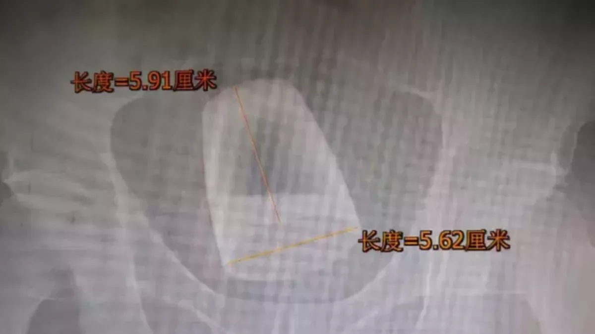 Default image