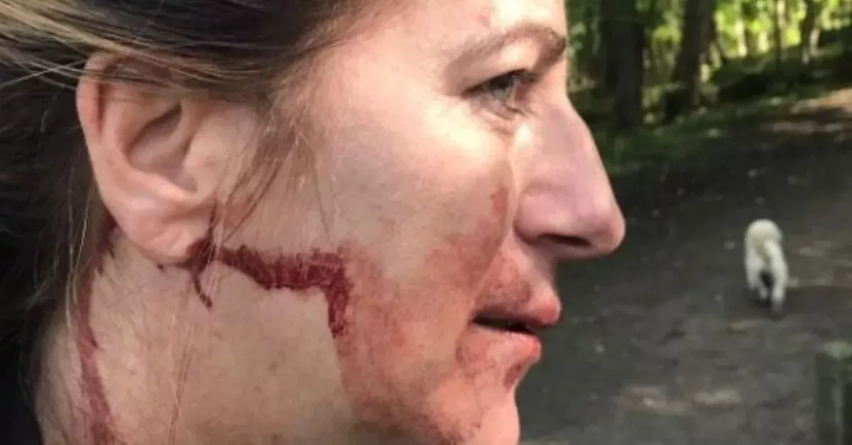 Dog Walker Left Unconscious 