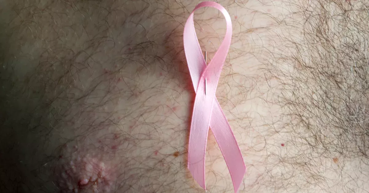 Men Die From Breast Cancer More Often Than Women
