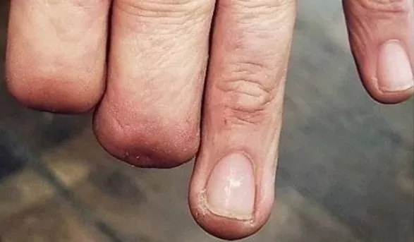 This Tattoo Artist Is Doing Something Incredible For Amputees
