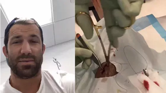 Luke Rockhold