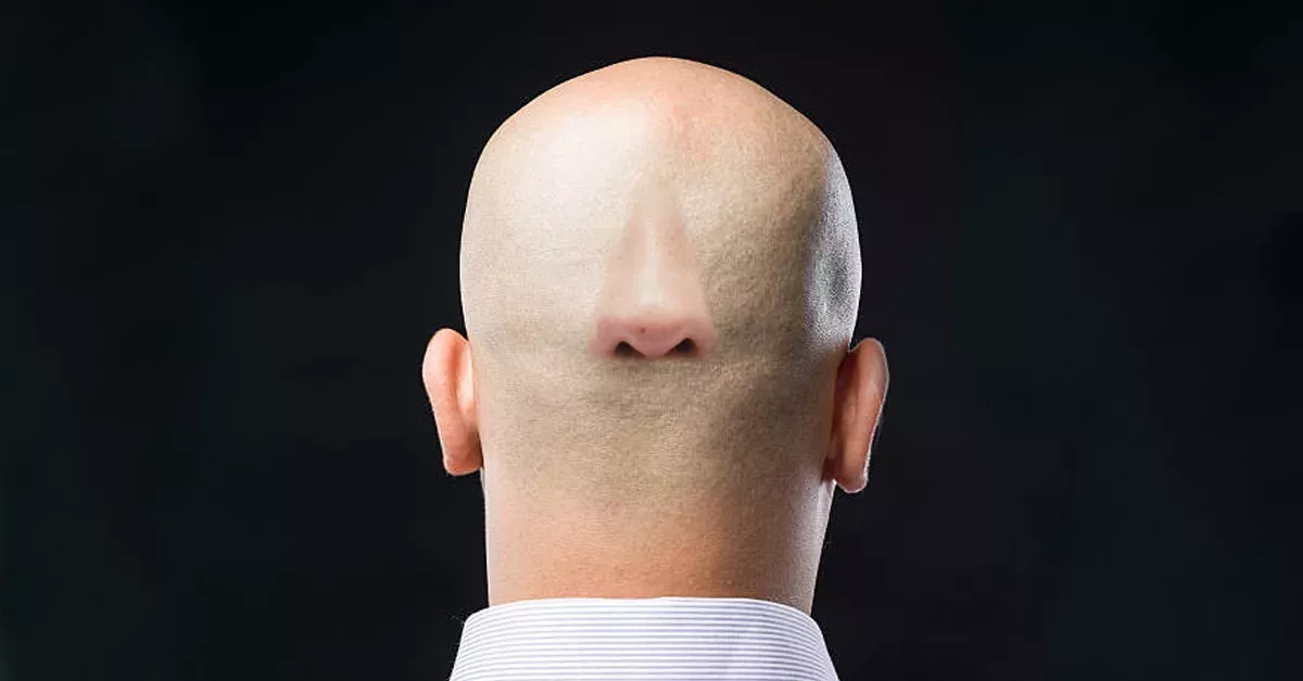 Default image
